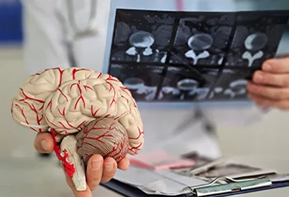 Brain Stroke Explained: Early Symptoms, Causes, and How You Can Take Action